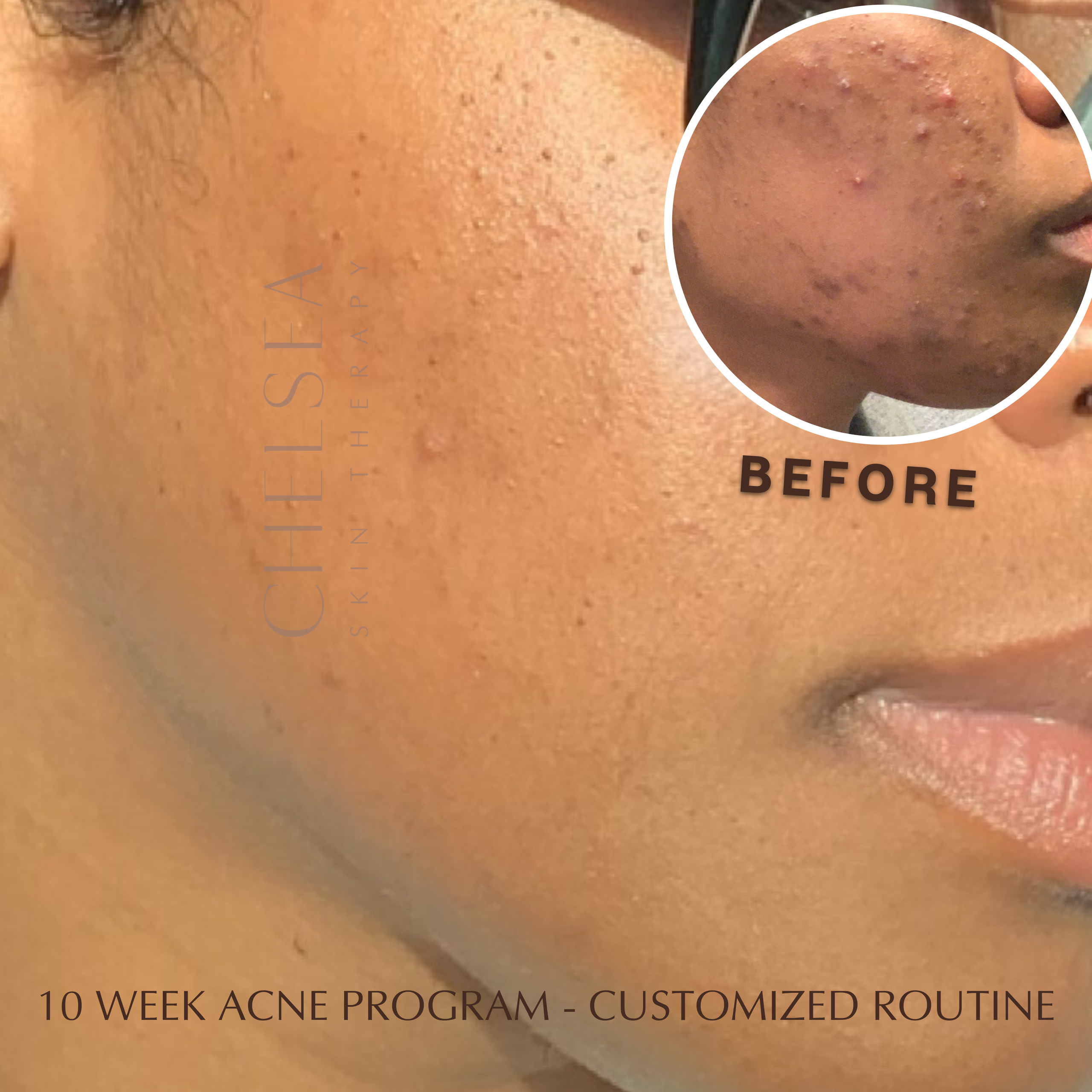 Acne chelsea hotsell